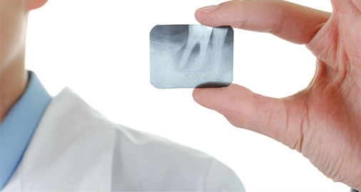 periodontal thumb2